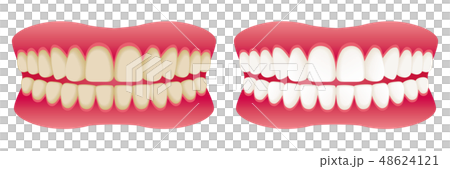 歯 ホワイトニング before after 広告イラスト 歯 ホワイトニング before after 広告イラスト 48624121