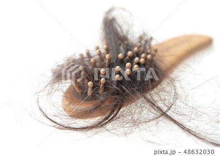 Hair loss problem. 48632030