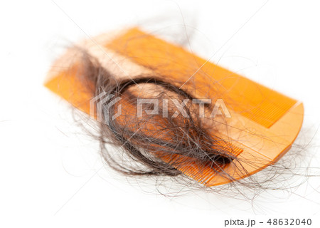 Hair loss problem. Hair loss problem. 48632040