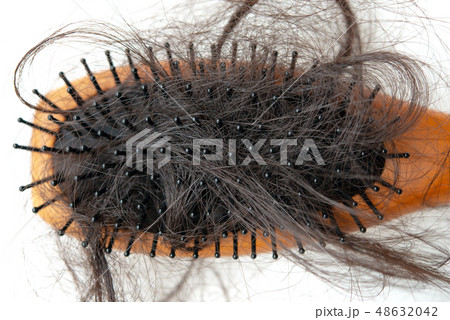 Hair loss problem. 48632042