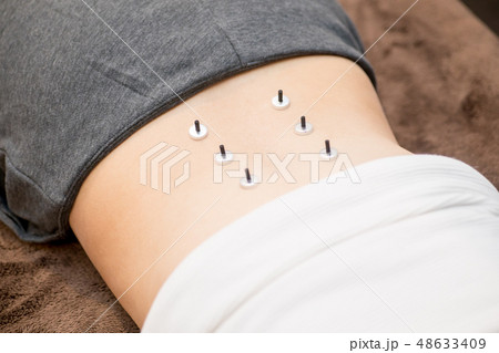 お灸をする女性 48633409