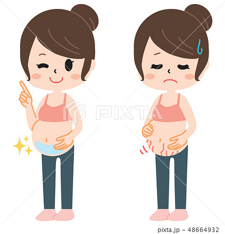 妊娠線に悩む妊婦さん２種類 48664932