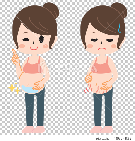 妊娠線に悩む妊婦さん２種類 48664932