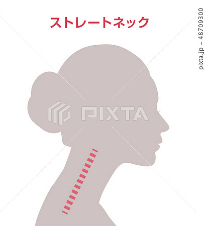 ストレートネック図 48709300