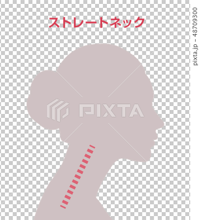 ストレートネック図 48709300