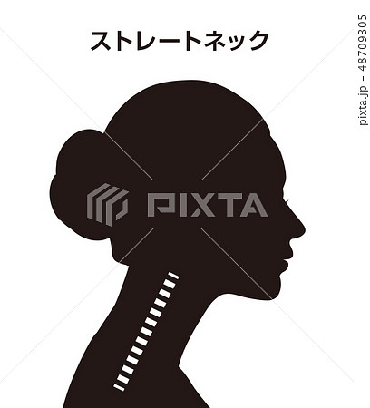 ストレートネック図 48709305