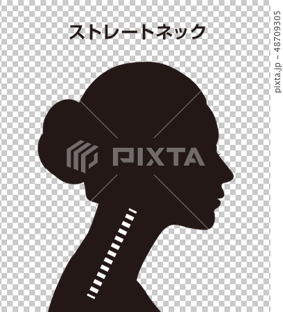 ストレートネック図 48709305