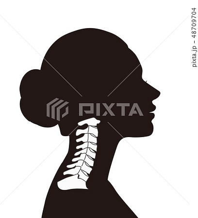 正常な頸椎 48709704