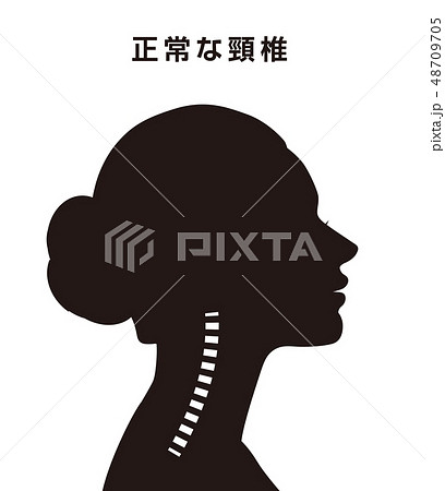 正常な頸椎 48709705
