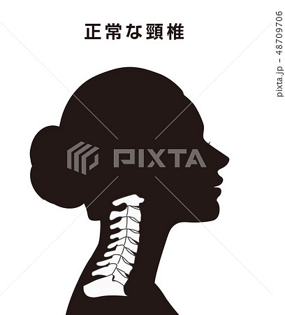 正常な頸椎 48709706