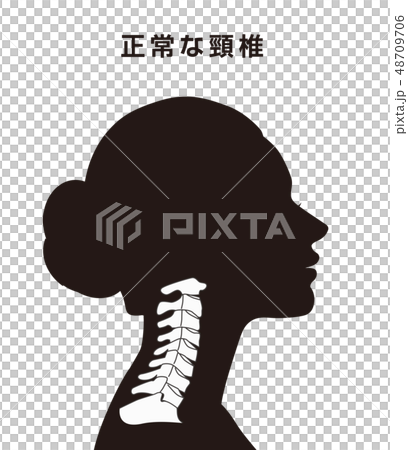 正常な頸椎 48709706