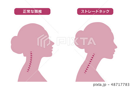 首骨格図　比較 48717783