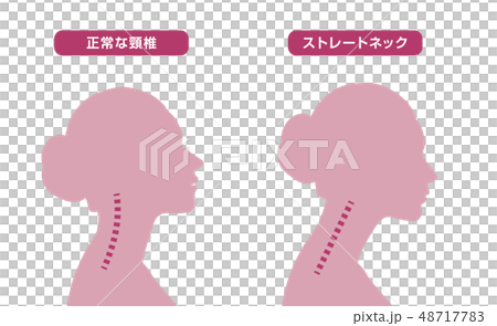 首骨格図　比較 48717783