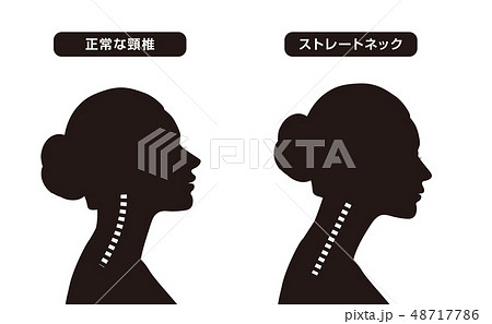 首骨格図　比較 48717786