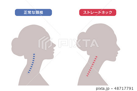 首骨格図 比較のイラスト素材