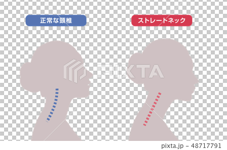 頸部骨架圖比較 頸部骨架圖比較 48717791