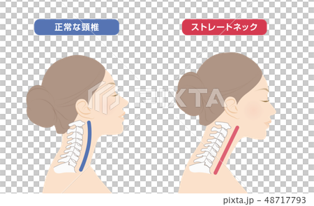 Comparison of neck skeleton diagram 48717793
