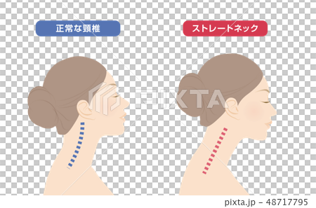 首骨格図　比較 48717795