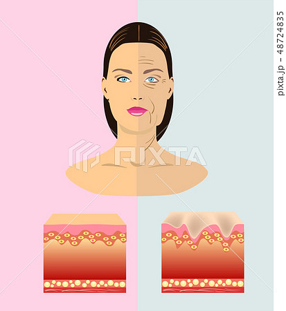 The difference between young and old skin, vector 48724835