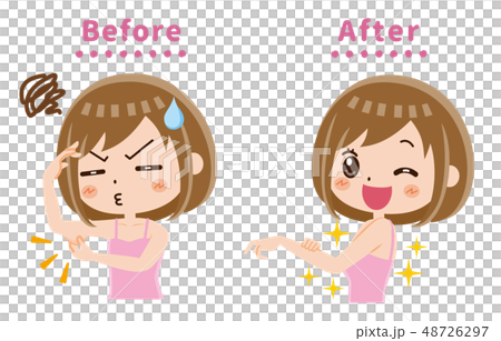 二の腕　ビフォーアフター 48726297