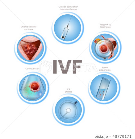 In Vitro Fertilization Infographics Round Icons 48779171