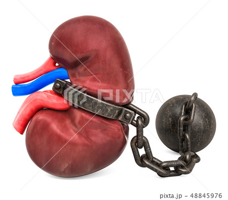 Kidney Pain concept. Human kidney with shackle 48845976