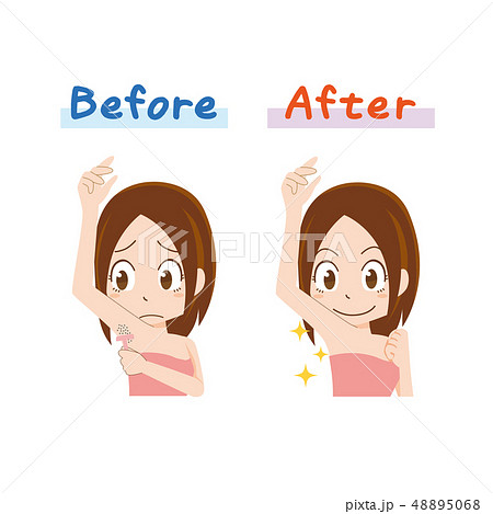 わき毛　ムダ毛　脱毛　永久脱毛　剃る 48895068