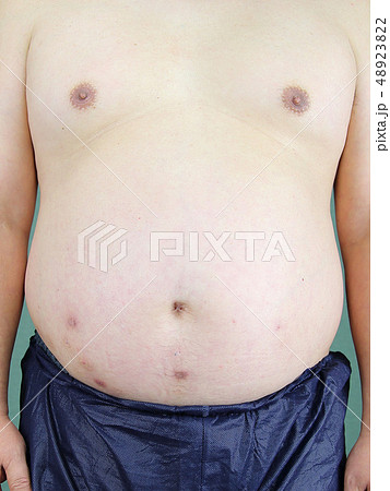メタボな中年男性 上半身の写真素材 4232