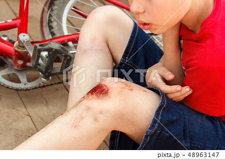 Broken wounded knee child.  48963147