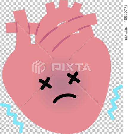 心臟異常 48990772