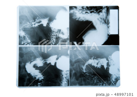 X-ray X-ray 48997101