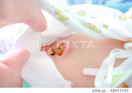 Newborn baby navel. Newborn baby navel. 49051433