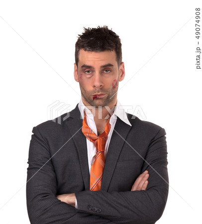 Close up of a businessman with bloody lip, beaten 49074908