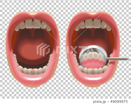 デンタルミラーで前歯の裏を見るのイラスト素材