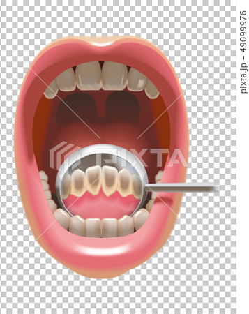The back of the front teeth is dirty The back of the front teeth is dirty 49099976