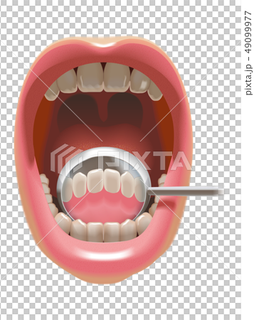 Look behind the front teeth with dental mirror Look behind the front teeth with dental mirror 49099977