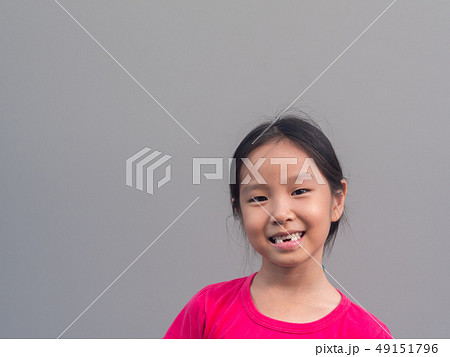 Asian little cute girl smile with her broken tooth Asian little cute girl smile with her broken tooth 49151796