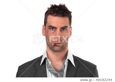 Close up of a businessman with bloody lip, beaten 49192244