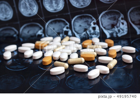 Pills on brain mri scan Pills on brain mri scan 49195740