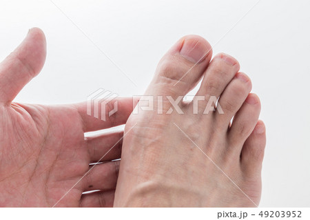 男性の足　痛風 49203952