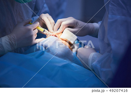 Plastic surgery of the eyelid in operating room, blepharoplasty. Plastic surgery of the eyelid in operating room, blepharoplasty. 49207416