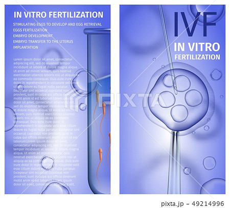 In Vitro Fertilization Vertical Banners Copy Space In Vitro Fertilization Vertical Banners Copy Space 49214996