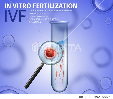 Close Up View Into Test Tube with Sperm and Egg Close Up View Into Test Tube with Sperm and Egg 49215557
