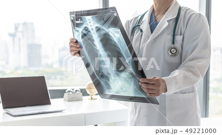 Doctor with radiological chest x-ray film patient 49221000