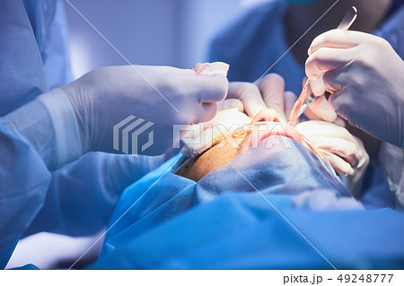 Blepharoplasty, plastic surgery operation for correcting defects, deformities, and disfigurations of Blepharoplasty, plastic surgery operation for correcting defects, deformities, and disfigurations of 49248777