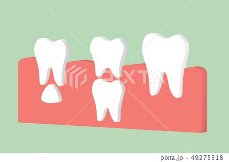 permanent tooth located below primary tooth permanent tooth located below primary tooth 49275318