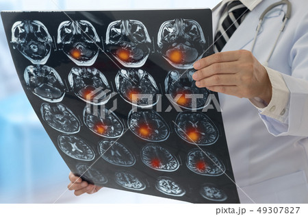 brain x-ray image brain x-ray image 49307827