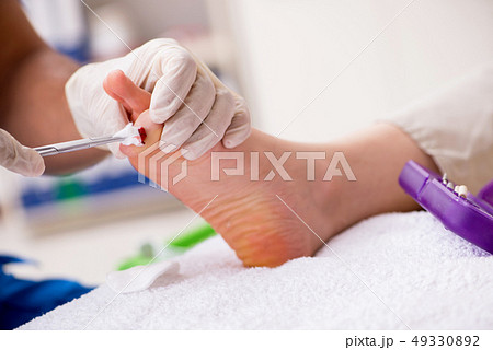 Podiatrist treating feet during procedure 49330892