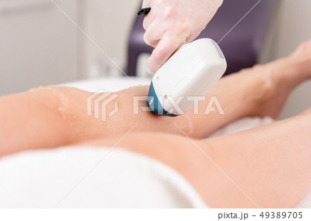 Laser epilation and cosmetology. Hair removal on ladies legs. at cosmetic beauty spa clinic 49389705
