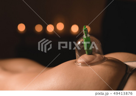 Close-up of wet caps for vacuum massage installed on the buttock of a young girl on the background Close-up of wet caps for vacuum massage installed on the buttock of a young girl on the background 49413876